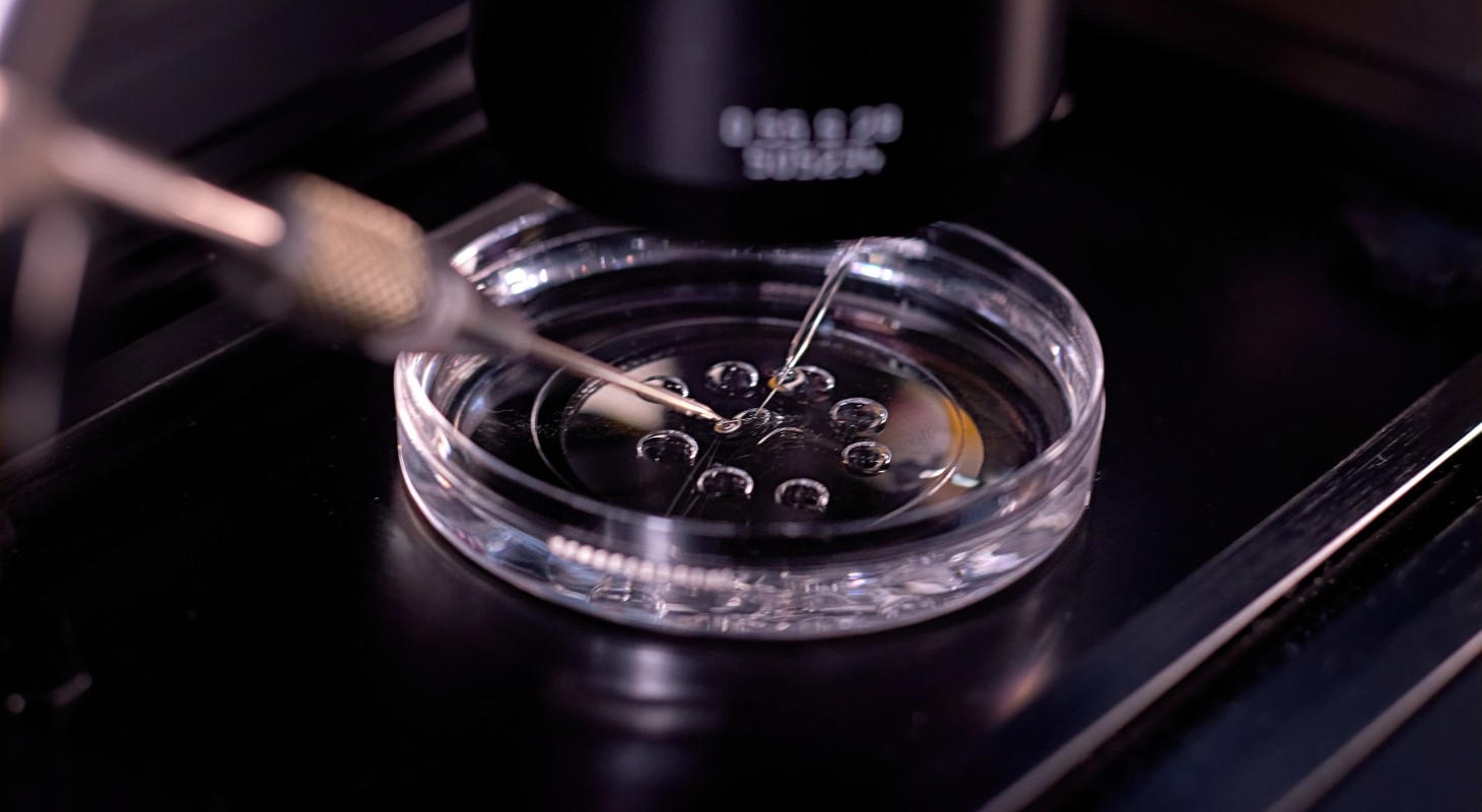 in vitro fertilization