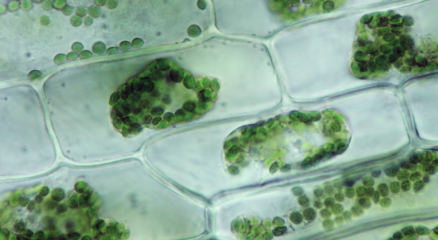 ELODEA. PLASMOLYSIS CELLS, EXPOSED TO 5%
