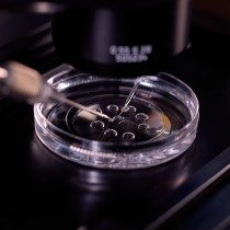 in vitro fertilization
